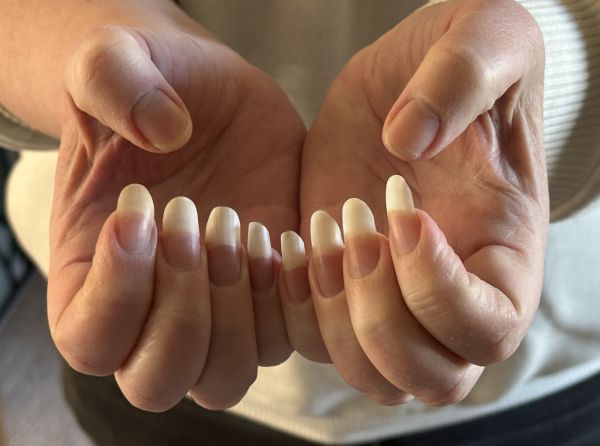 Lost another fingernail