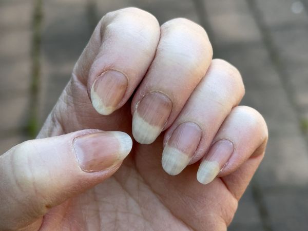 Fingernails red