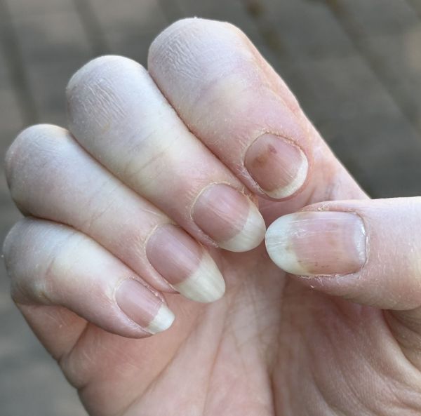 Fingernails red