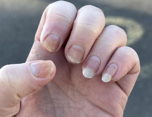 Fingernails