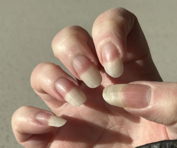 Long fingernails