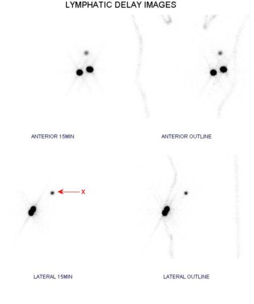 CIG radiography