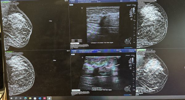 The diagnostic scans